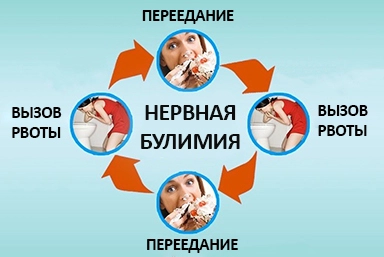 Лечение булимии в Дубне